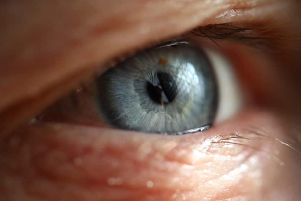 Pourquoi de plus en plus de patients choisissent la chirurgie laser pour traiter leur cataracte  ?